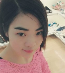 重庆华美单磊硅胶假体隆鼻手术案例~