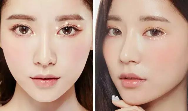 韩式定点双眼皮