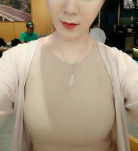 【曼托妙桃400cc水滴形假体隆胸日记——等你等得好辛苦~】