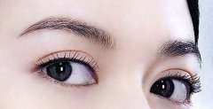 北京双眼皮术后恢复5个阶段