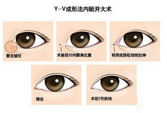 整形医院秘密公开一览