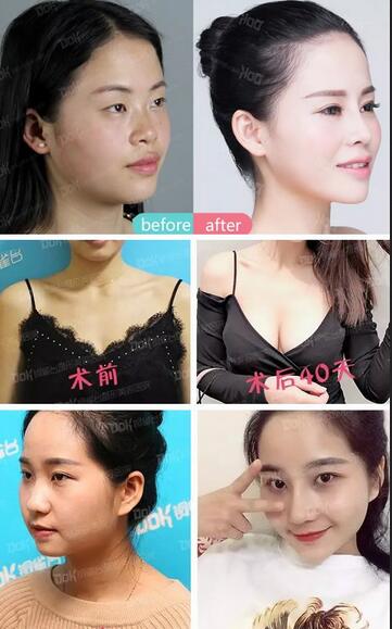 成都铜雀台真人案例