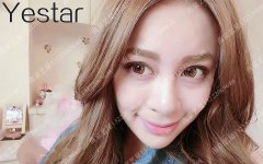 南京艺星汪树杰做的6mm双眼皮，来围观果吧~