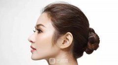 玻尿酸隆鼻、隆鼻、自体软骨隆鼻、鼻部手术科普~