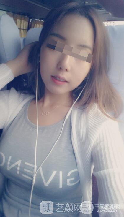 成都玉之光刘中国自体脂肪丰胸图日记