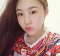 重庆美联臣整形美容医院怎么样?切开双眼皮案例分享~