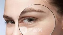 脂肪胶，重现眼部年轻紧致~