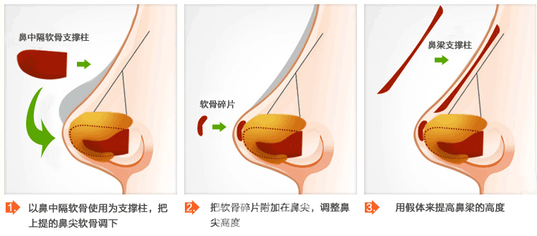 嘉兴华山整形医院怎么样，口碑医生详情一览