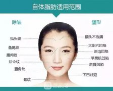 重庆当代整形医院自体脂肪填充照真人案例