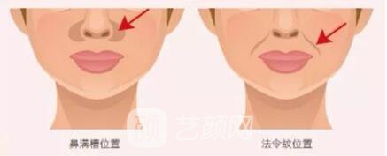 别再为法令纹犯愁了，用这两种方法摆平它