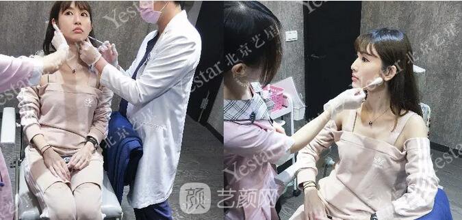 北京艺星整形医院注射瘦脸￥499 | 打完半个月，来看看果!