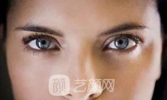哪些情况适合开眼角？