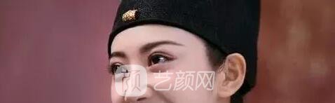 天津美莱整形对双眼皮的误解之——“越宽越好看?”