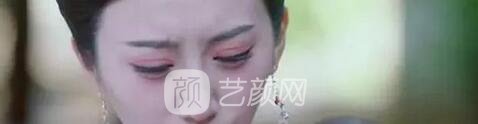 天津美莱整形对双眼皮的误解之——“越宽越好看?”