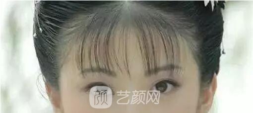 天津美莱整形对双眼皮的误解之——“越宽越好看?”
