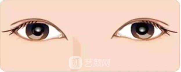 天津美莱整形对双眼皮的误解之——“越宽越好看?”