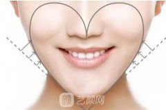 玻尿酸隆下巴好不好?玻尿酸隆下巴果怎么样?
