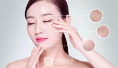像素激光去痘坑果