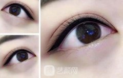 纹眼线几天能恢复？