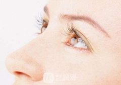 生物焊接双眼皮价格？多少钱