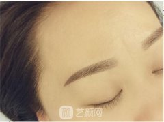 秀眉一般要多少钱