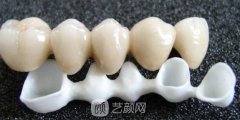 钯金烤瓷牙的优点有哪些？