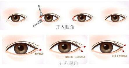 【开眼角有危险吗？】