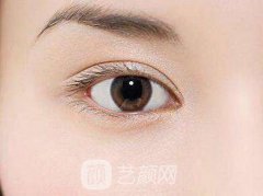 生物焊接双眼皮需要多少钱