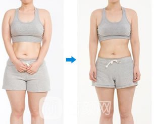 360吸脂减肥果怎么样，价格贵不贵