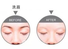 洗眉痛吗