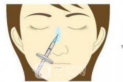 注射隆鼻前后对比