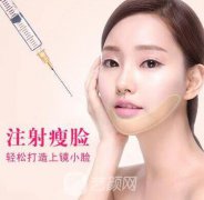 注射瘦脸多少钱一支