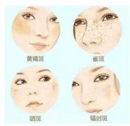 北京光子嫩肤价格