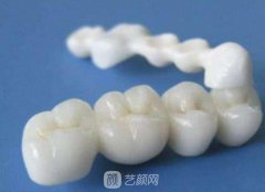 北京烤瓷牙价钱？烤瓷牙多少钱？