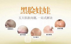 黑脸娃娃一次多少钱