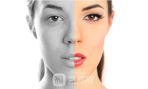 【伊维兰除皱果怎么样?伊维兰除皱果图~】