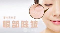 眼部除皱价格多少？眼部除皱价格影响因素