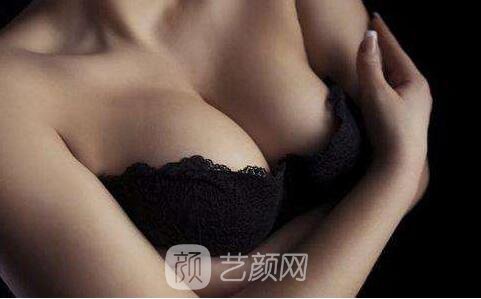 北京隆胸多少钱