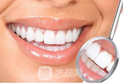 成都镍铬烤瓷牙多少钱