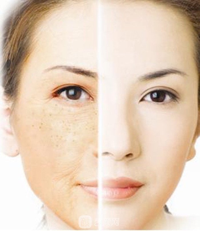 北京彩光嫩肤手术哪里比较好