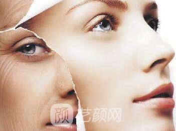 宁夏拉皮除皱手术的价格是多少