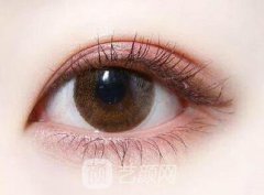 微创3d美雕双眼皮是什么？果怎么样？