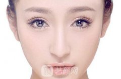 芭比双眼皮适合人群有哪些？是长久的吗？