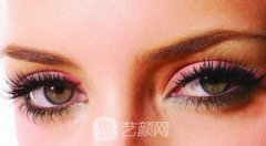 全切双眼皮风险大吗？需要注意什么？