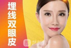 埋线双眼皮多久恢复？适合哪些人做？
