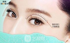 韩式定点双眼皮多久能化妆？