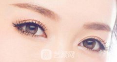韩式定点双眼皮副作用有哪些？