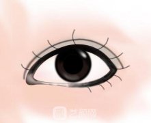 开眼尾有什么危害?注意事项有哪些?