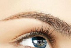 开眼尾恢复期?开眼尾手术恢复期多久?