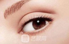 苏州开眼尾多少钱?价格贵吗?